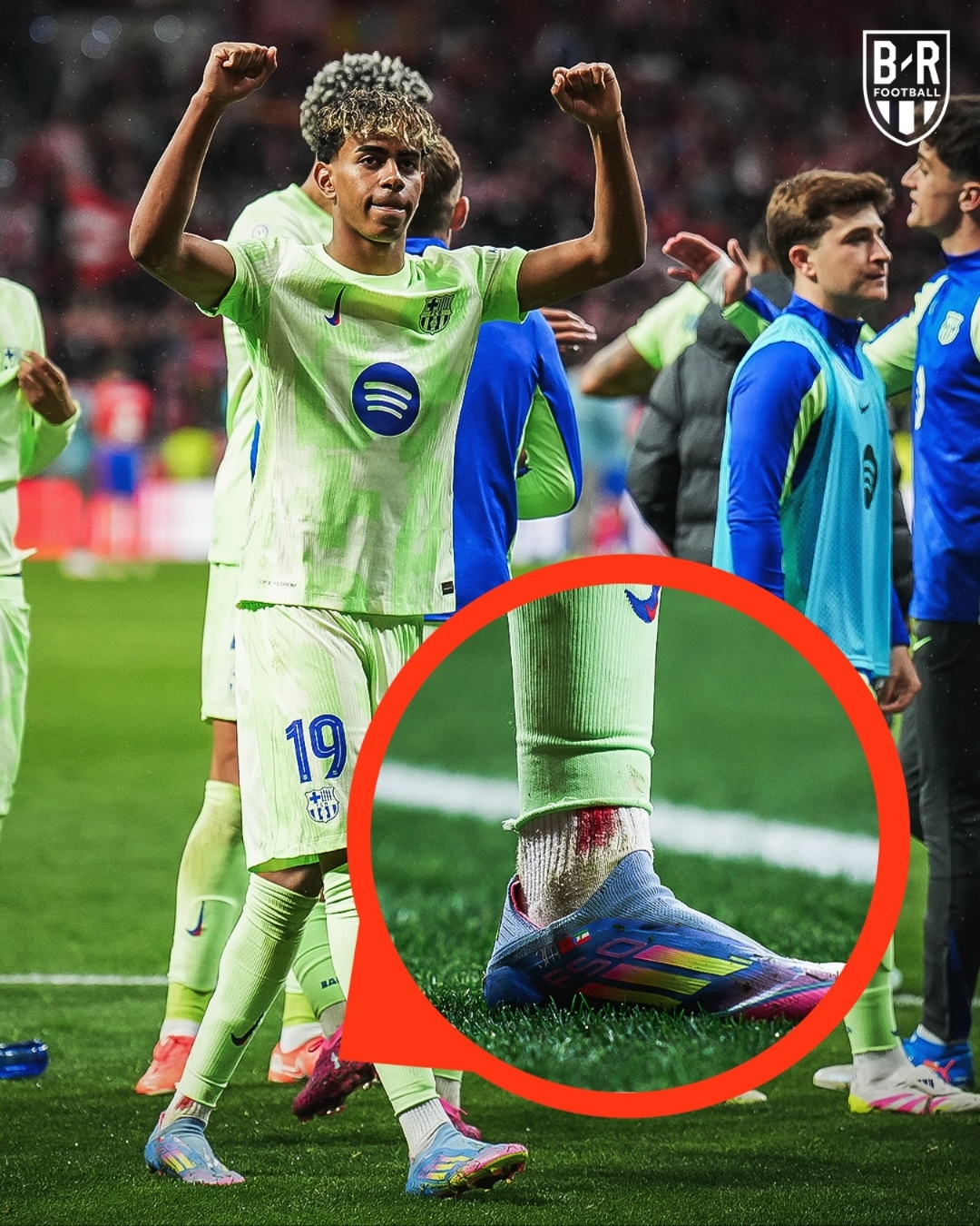 爱游戏官网-马赛球队前锋受伤，或告别赛季比赛的简单介绍